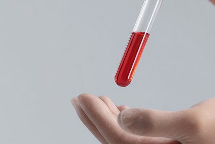 Антитела к коклюшному токсину, IgG