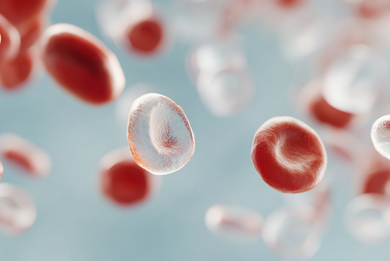 Антитела к вирусу простого герпеса I, II типов (Herpes simplex virus I, II), IgM
